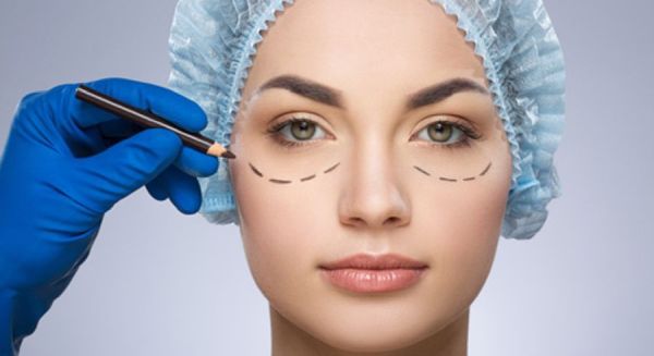 Blefaroplastia